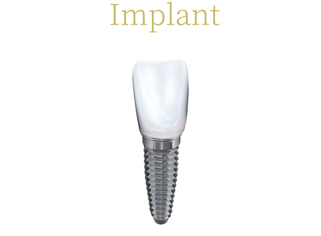 Implant