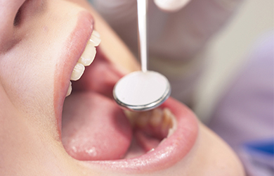 虫歯や歯周病を、予防治療で早期発見・早期治療